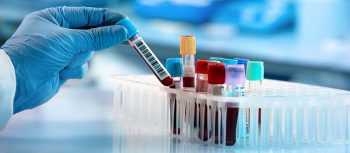عوامل تاثیر گذار بر قیمت مواد آزمایشگاهی و مواد شیمیایی